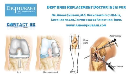 Best Knee Replacement Doctor in Jaipur