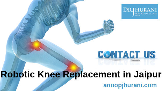 Robotic Knee Replacement in Jaipur