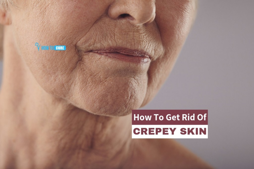 https://howtocure.com/how-to-get-rid-of-crepey-skin/