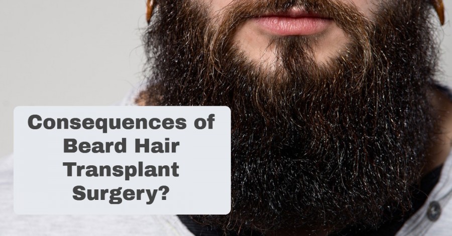 Facial hair transplant- Consequences of Beard Hair Transplant Surgery?