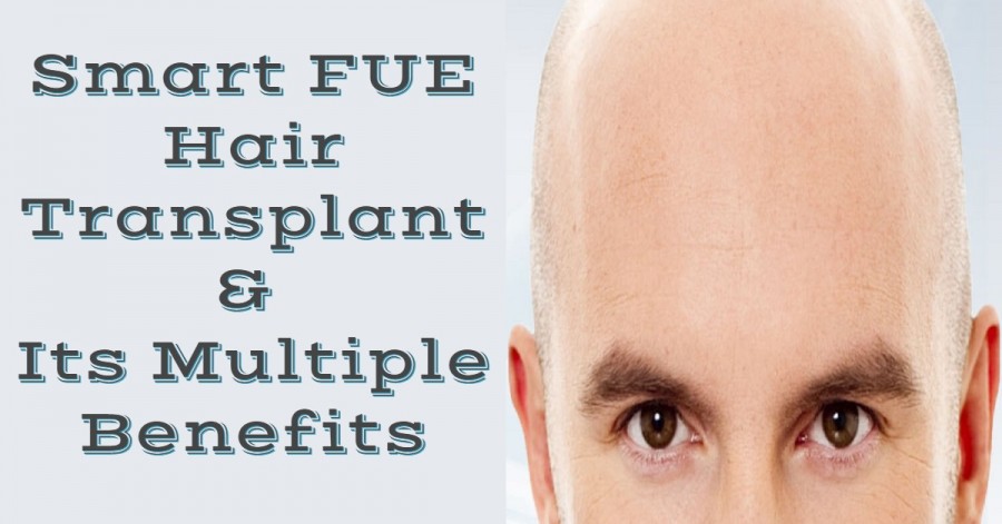 fue transplant- Smart FUE Hair Transplant and its Multiple Benefits