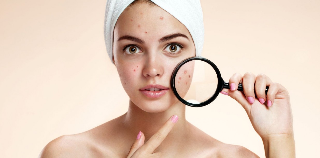 How to Treat Skin Problems