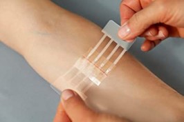 Global Wound Closures Devices Market, Wound Closures Devices Market, Wound Closures Devices, Wound Closures Devices Market Comprehensive Analysis, Wound Closures Devices Market Comprehensive Report, W