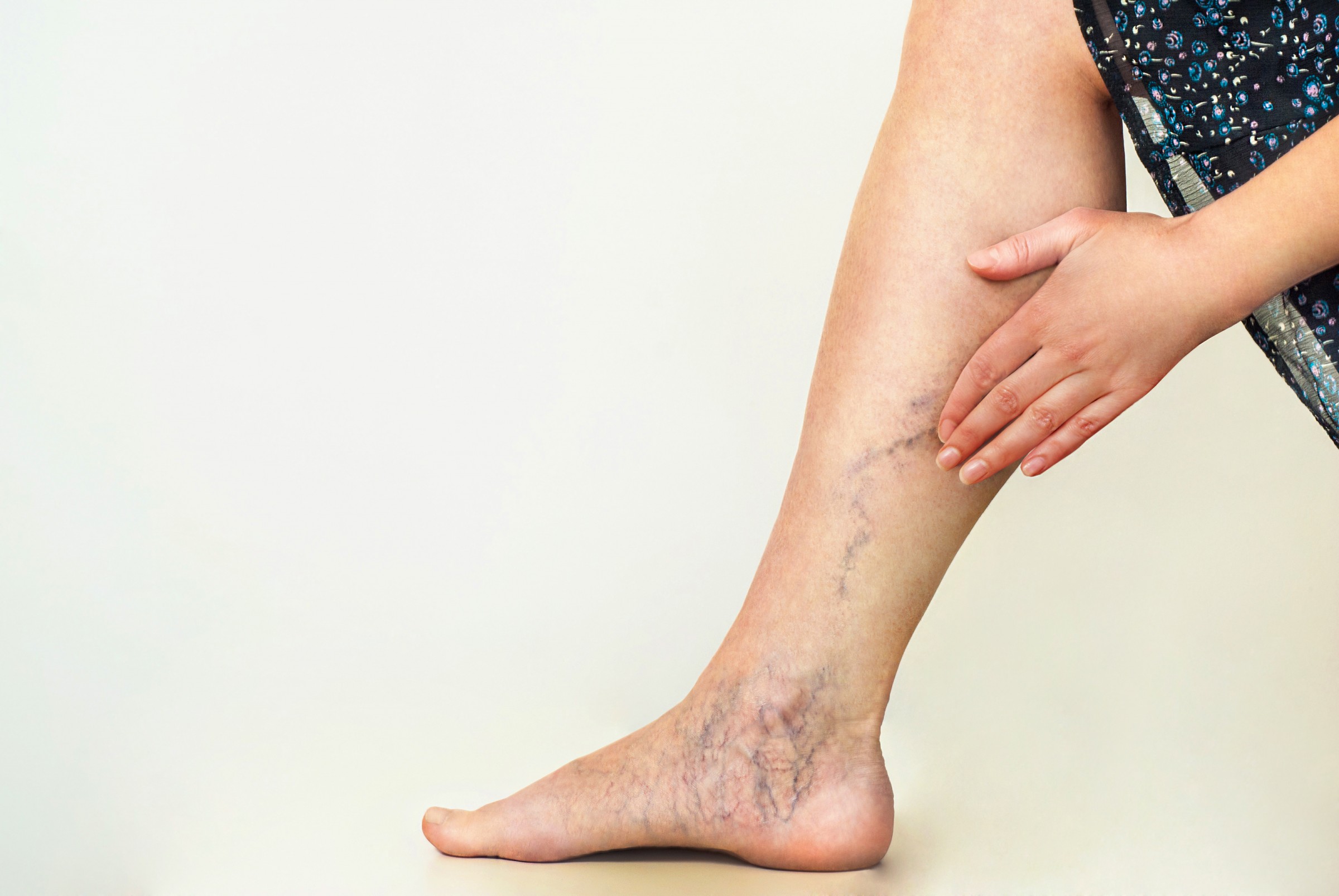 vein centers texas