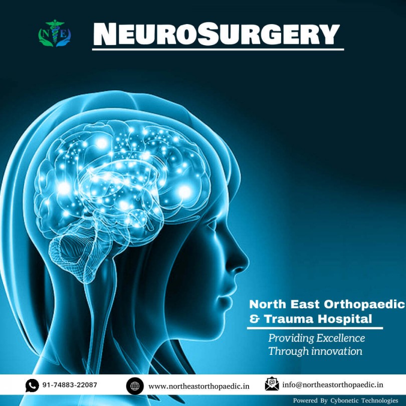 Best Neuro Hospital in Patna, Best neuro doctor in Patna