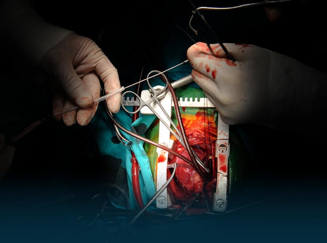 Top Cardiothoracic Surgeons in India