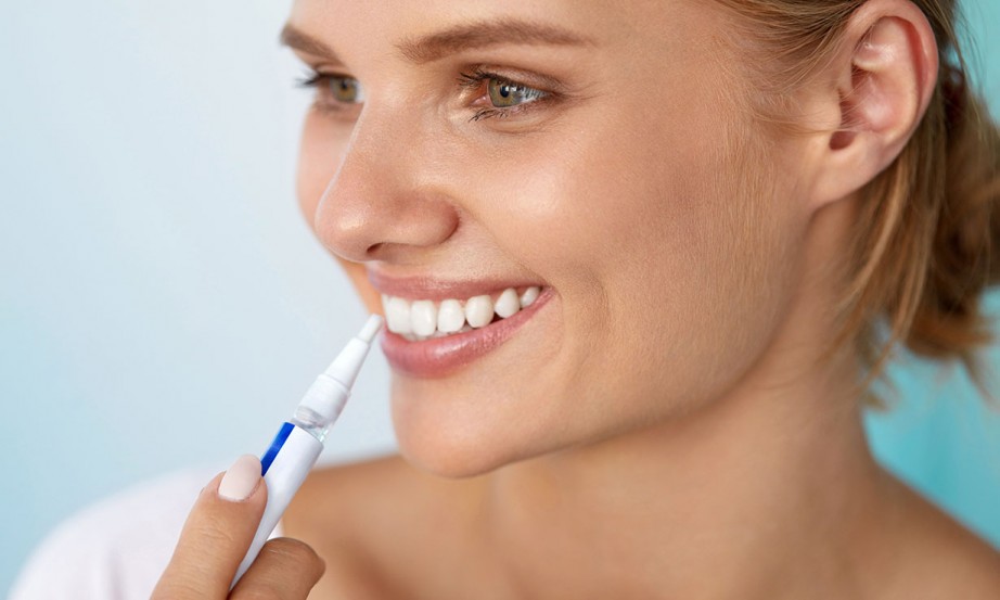 At-Home Teeth Whitening Kits