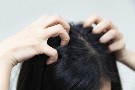 Get Rid of Oily Scalp