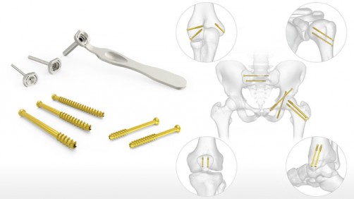 cannulated screws