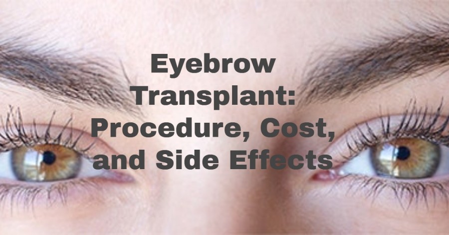 Eyebrow Transplant: Procedure, Cost, and Side Effects - Eyebrow Transplant