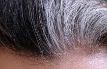 reverse gray hair naturally