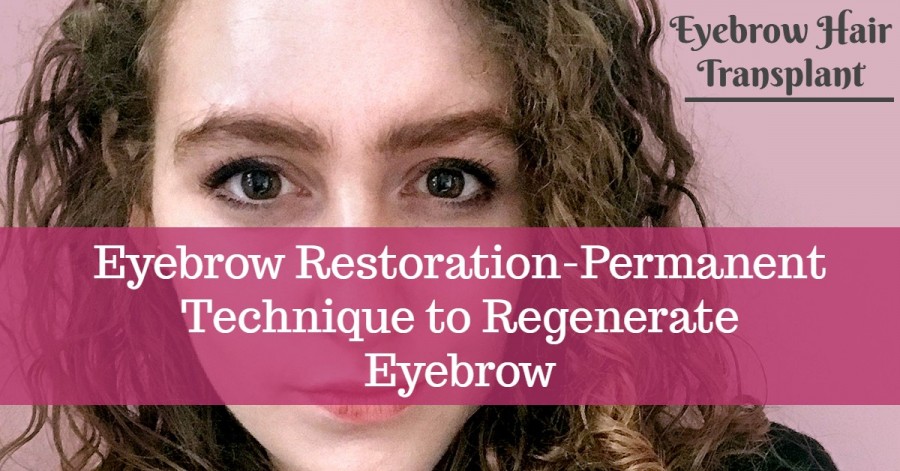 Eyebrow hair transplant- Eyebrow Restoration-Permanent Technique to Regenerate Eyebrow