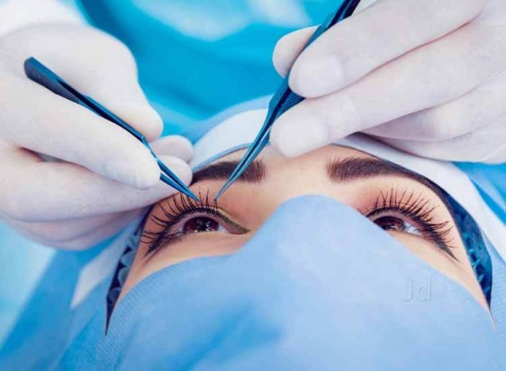 10-most-common-types-of-corrective-eye-surgery